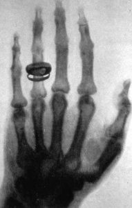 fun facts about radiology in 2025 starting with the discovery of x ray