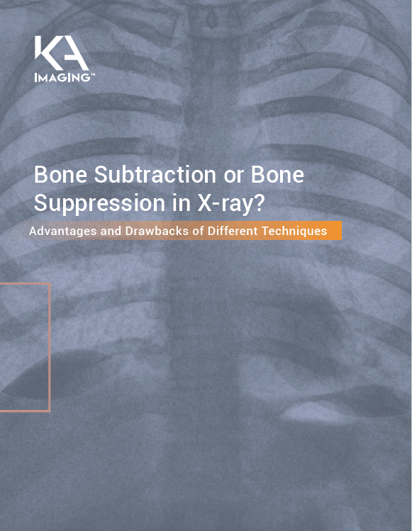 bone suppression vs bone subtraction