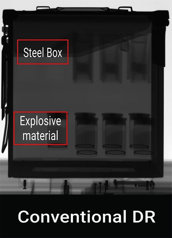 Top Features to Look for in X-Ray for EOD