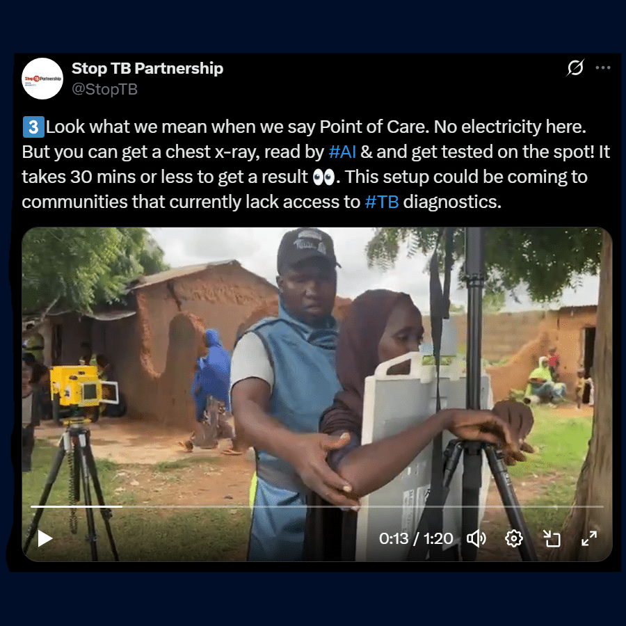 Remote Access Imaging in Global Health Stop TB Project with KA