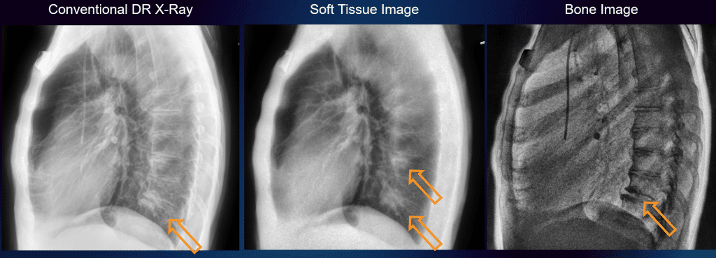 lateral dual energy imaging x ray example