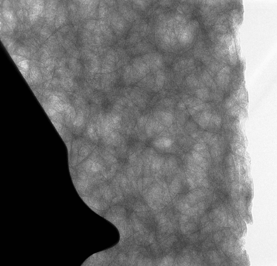 biomedical imaging example soft tissue and bone imaging case study