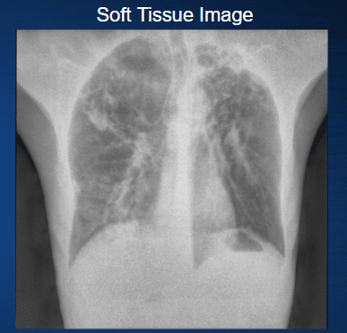 How Spectral X-ray Imaging Works