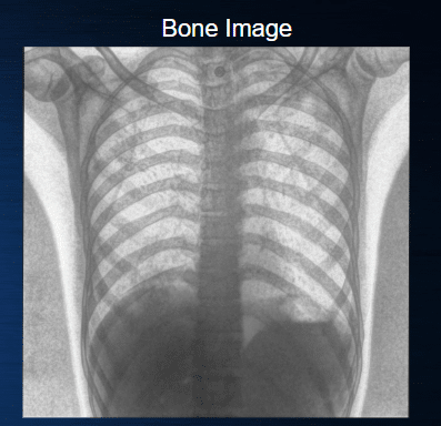 How Spectral X-ray Imaging Works