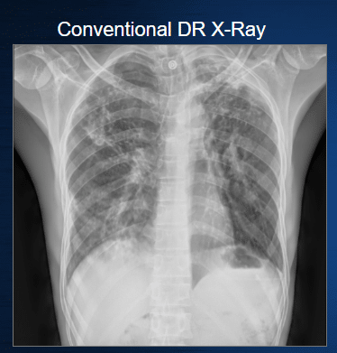 How Spectral X-ray Imaging Works